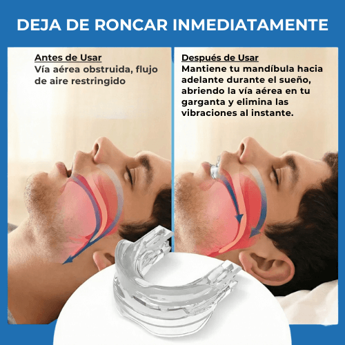 DuoSleep®️ - Kit Antironquido