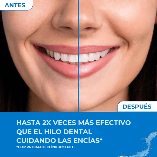 OralPure®️ - Irrigador Bucal Profesional
