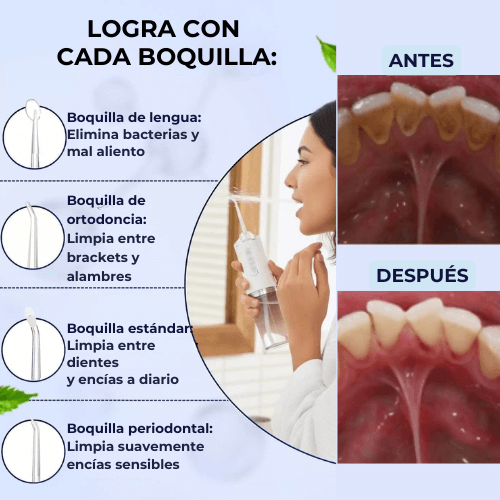 OralPure®️ - Irrigador Bucal Profesional